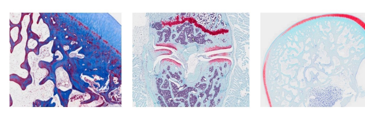 Orthopedic Histopathology Service Center Department Of Orthopedics